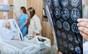 Annals of Neurology: стрессовые события в детстве повышают риск развития болезни Альцгеймера
